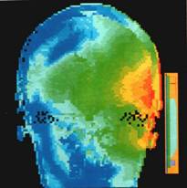 Heating of brain while using a mobile phone Thermal image of head and mobile phone