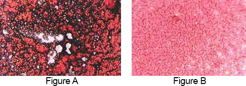 Microscope view of blood before and after detoxification